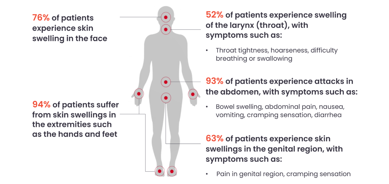 Symptoms